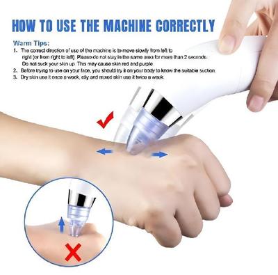 Dead Skin Removal Derma Suction Facial Cleanser